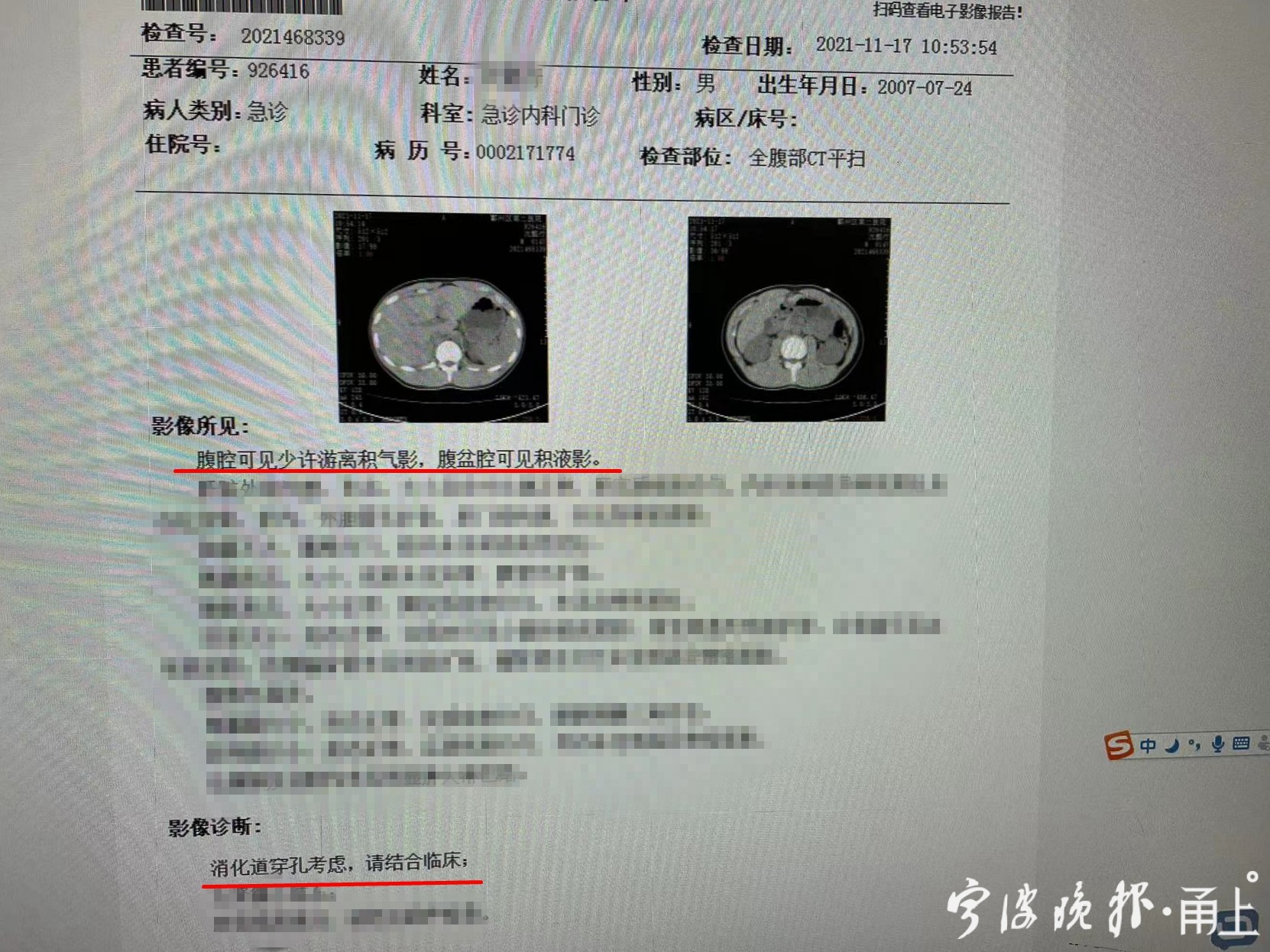 泡面当饭吃,饮料当水喝,宁波15岁男孩考场上突发胃溃疡穿孔!